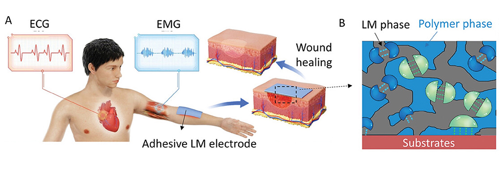 Scheme showing the feasibility of the adhesive LM electrode and the design principle.