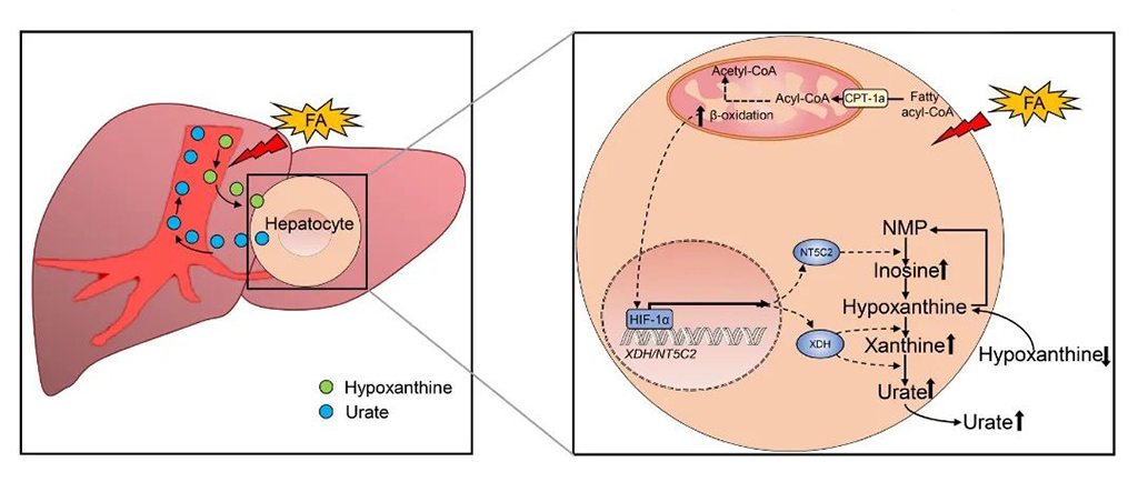 Figure: Fatty acid oxidation induces HIF-1α and transcriptionally activates XDH/NT5C2 to promote hepatic urate synthesis.