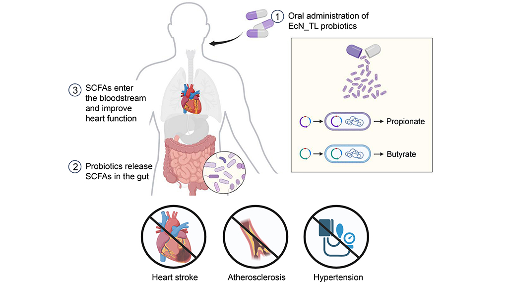 Novel SCFA secreting probiotics prevent myocardial injury caused by ischaemic heart disease.