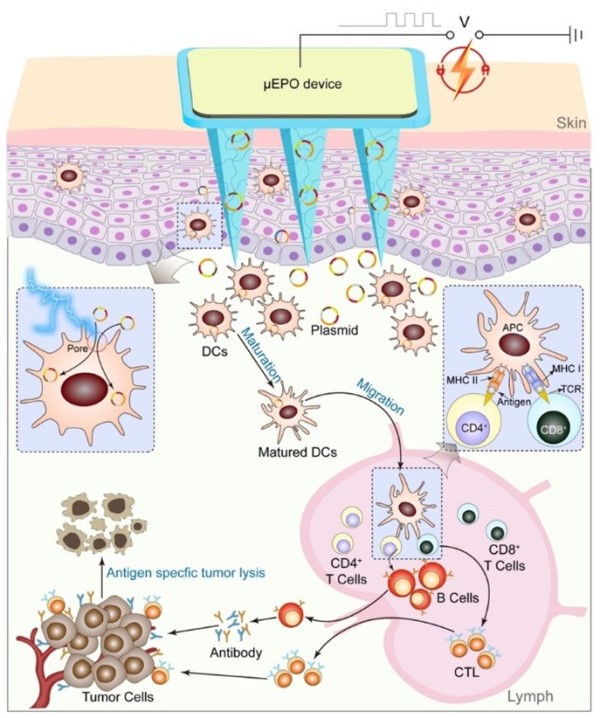 Schematic of transdermal microarrayed electroporation for enhanced cancer immunotherapy based on DNA vaccination.