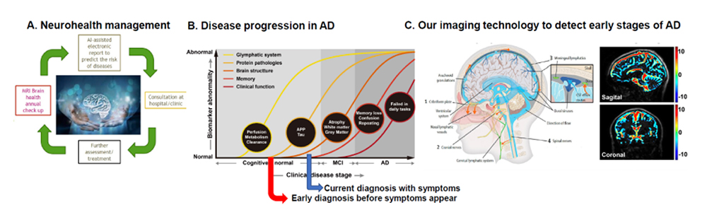 Neuroscience and Anti-ageing Technology