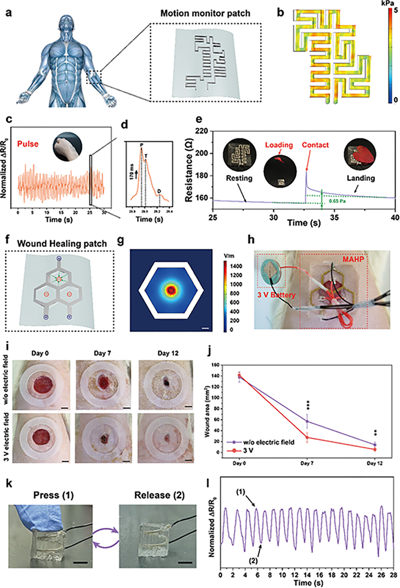 Programmable Microfluidic-Assisted Highly Conductive Hydrogel Patches for Customizable Soft Electronics